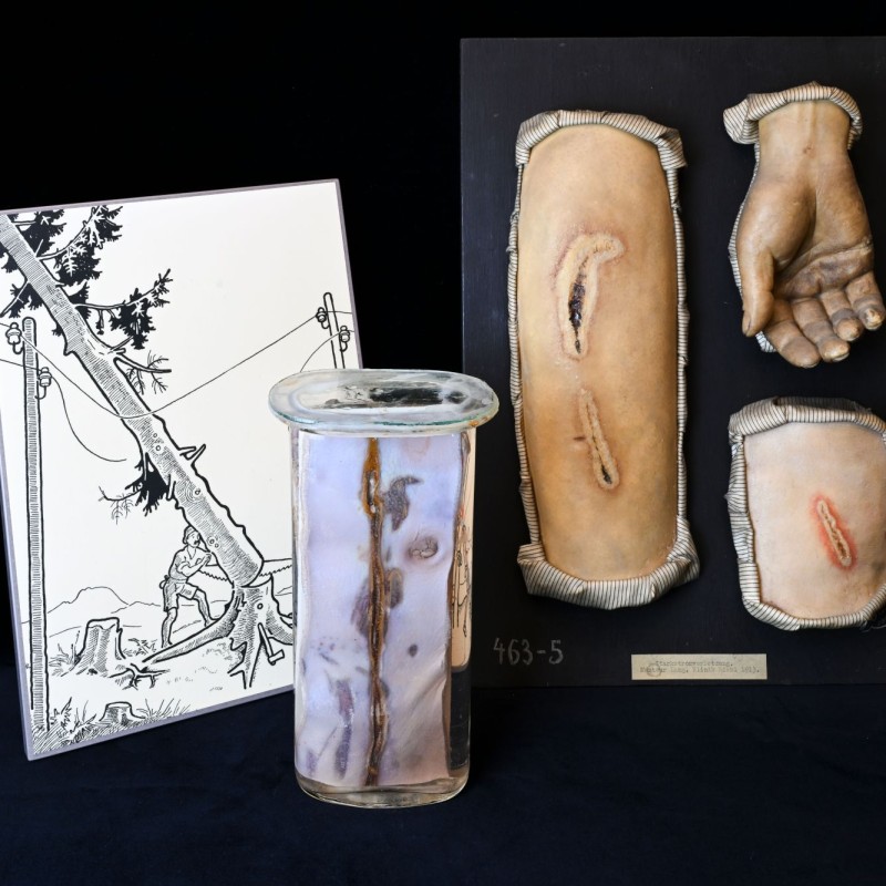 Ein Bild, ein Glas, eine Moulage zur Ausstellung 