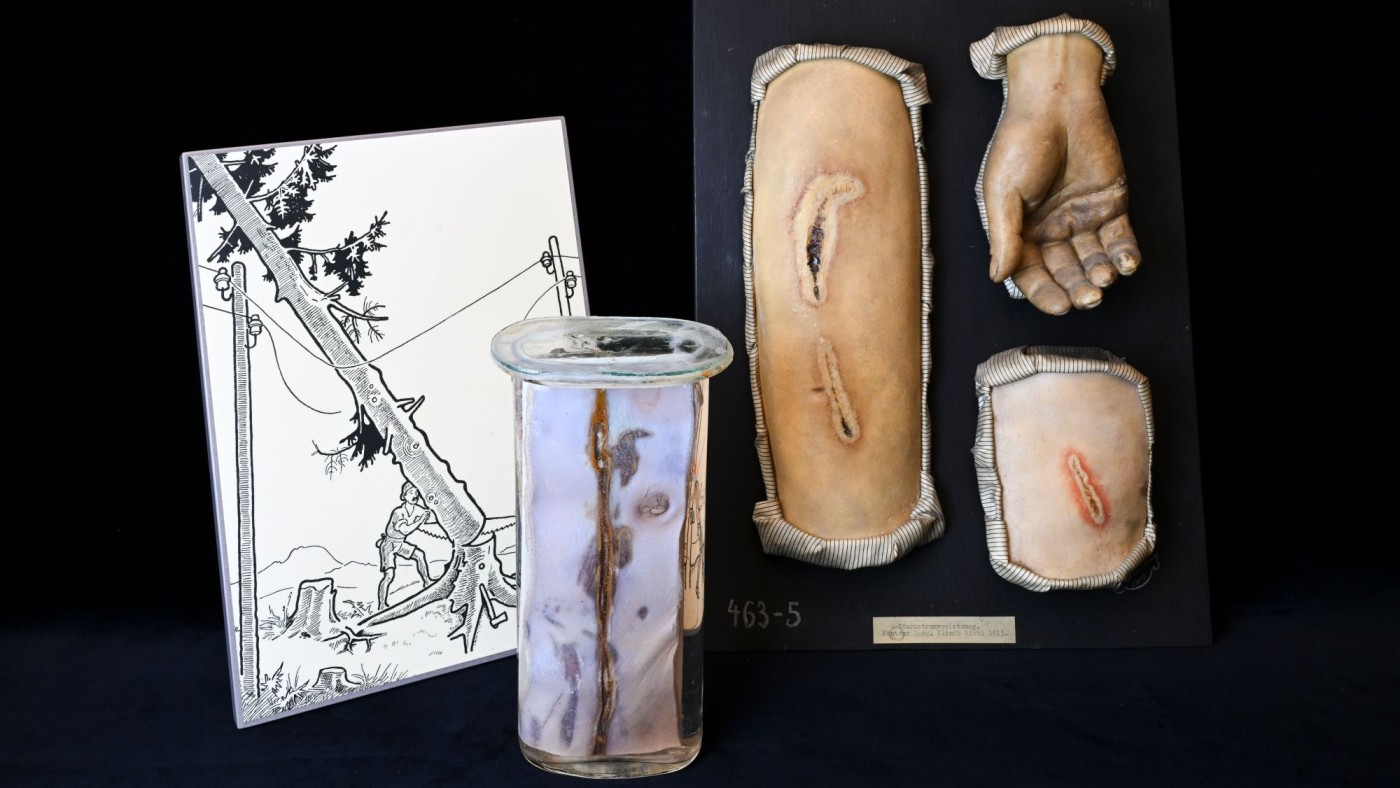 Ein
                                 Bild, ein Glas, eine Moulage zur Ausstellung 