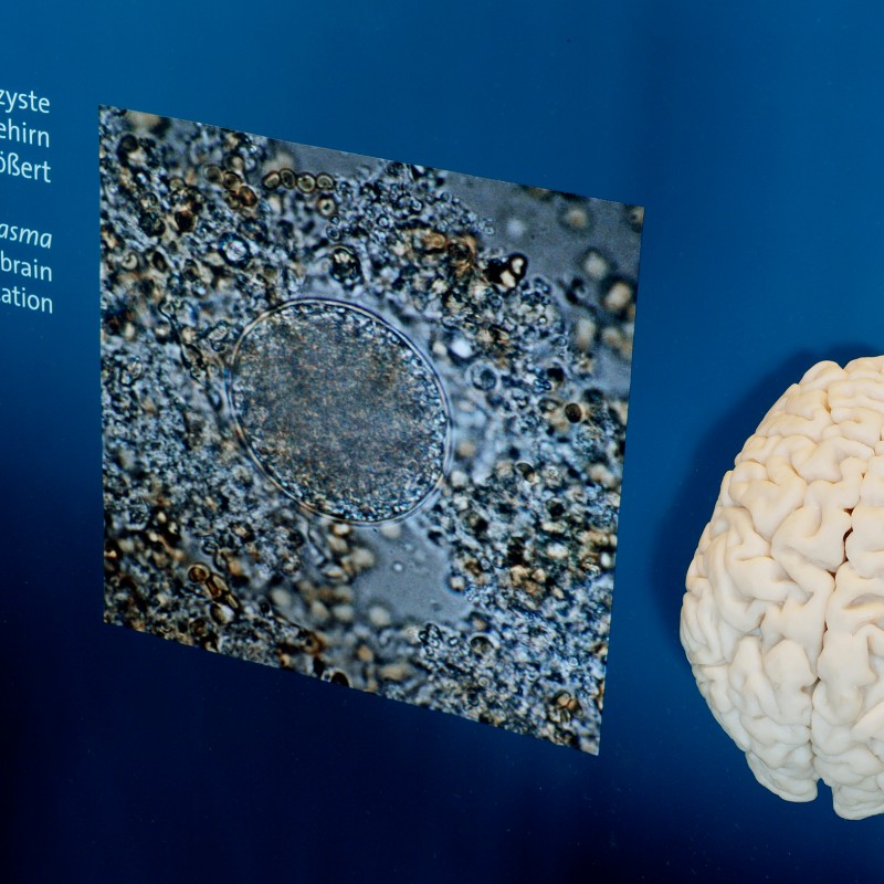 Close-up of a Toxoplasma cyst under a microscope next to a model of a human brain. Legible text on the left. (AI-generated
                                 alt-text, generated with GPT-4.1-mini)