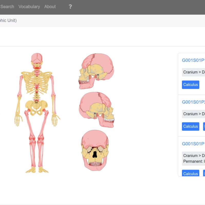 Color-marked human skeleton drawings in front, back, and side view, plus skull detail views. On the right, a list
                                 view of find data with blue buttons and text. (AI-generated alt-text, generated with GPT-4.1-mini)