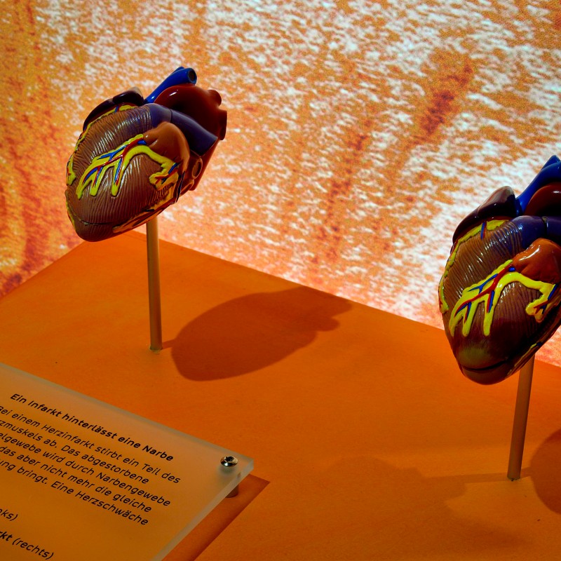 Zwei nachgebildete menschliche Herzen mit farbigen Markierungen auf gelber Präsentationsfläche vor leuchtendem Hintergrund.
                                 Eine Info-Tafel mit Text davor. (KI-generierter Alt-Text, erstellt mit GPT-4.1-mini)