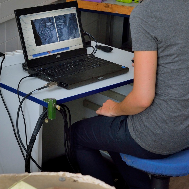 Woman in a grey T-shirt sitting in front of an open laptop displaying two black-and-white X-ray images. Foreground
                                 shows a plaster cast with bone fragments. (AI-generated alt-text, generated with GPT-4.1-mini)