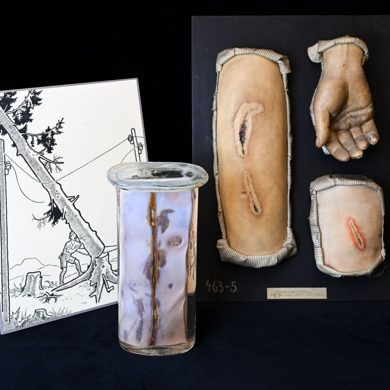 Pictures of body parts injured by electricity and a drawing depicting an electrical
                                 accident