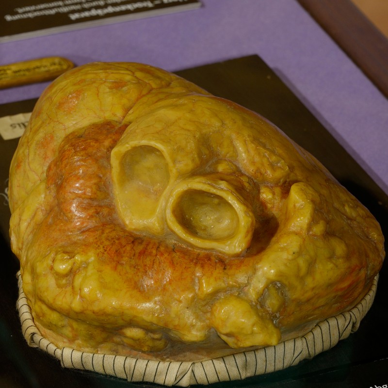 Yellowish heart model replica made of plastic with two clearly visible openings, displayed on a tray. (AI-generated
                                 alt-text, generated with GPT-4.1-mini)