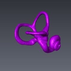 : Knöcherner Teil des menschlichen Innenohrs © Anne Le Maître