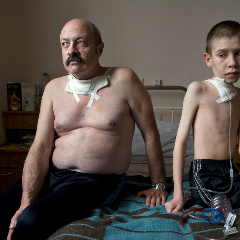 An older man and a boy sit on a bed, both with medical bandages and tubes at their necks, the boy appears very thin.
                                 (AI-generated alt-text, generated with GPT-4.1-mini)