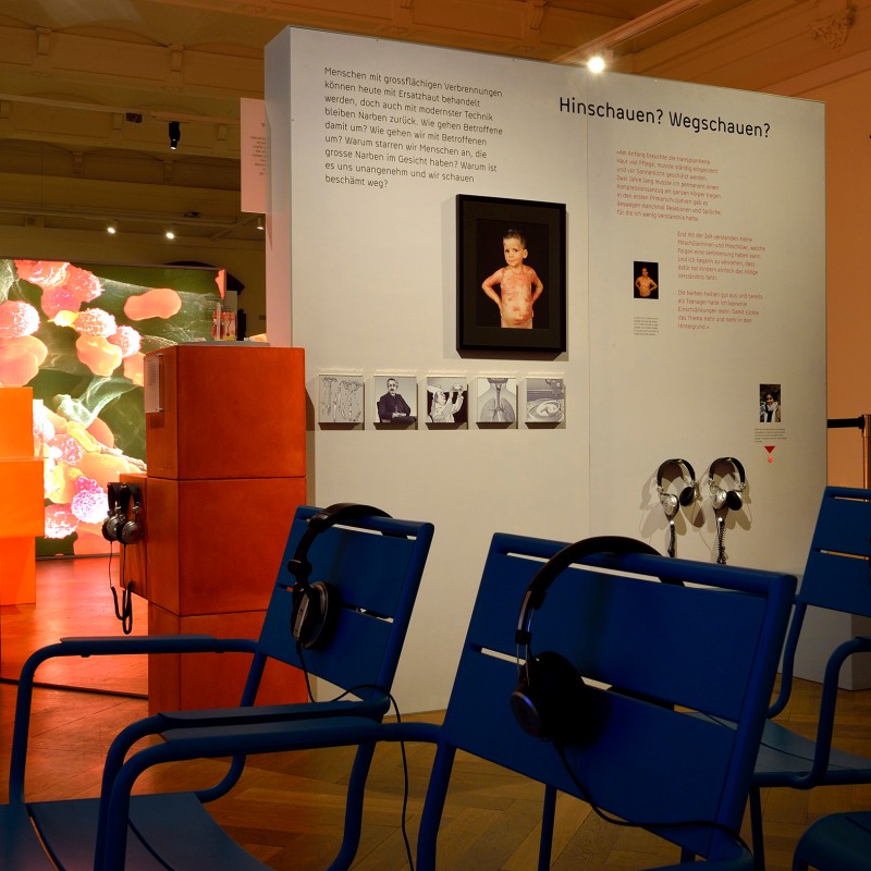 Blaue Stühle mit Kopfhörern vor einer Ausstellungstafel mit Texten und Porträt eines Kindes mit Brandnarben. (KI-generierter
                                 Alt-Text, erstellt mit GPT-4.1-mini)